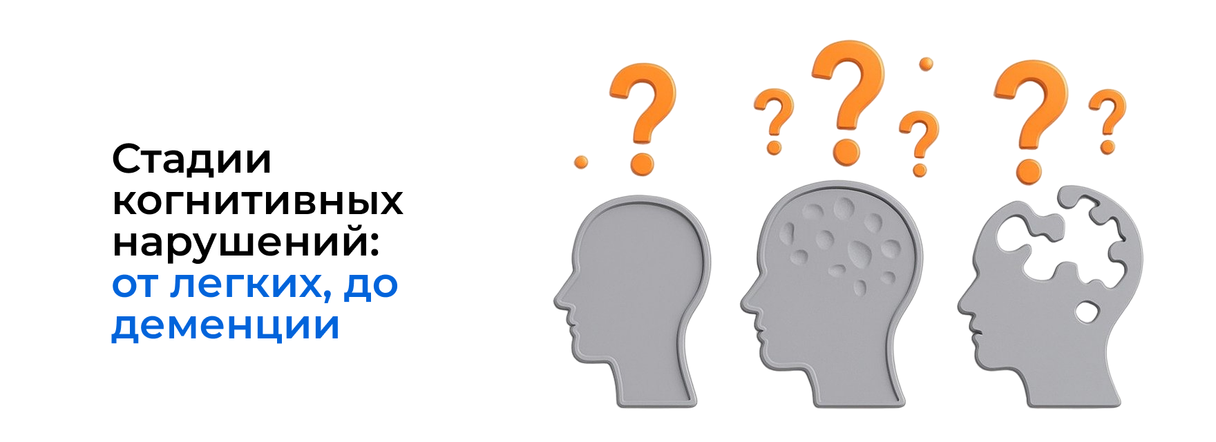 Стадии когнитивных нарушений: от легких, до деменции